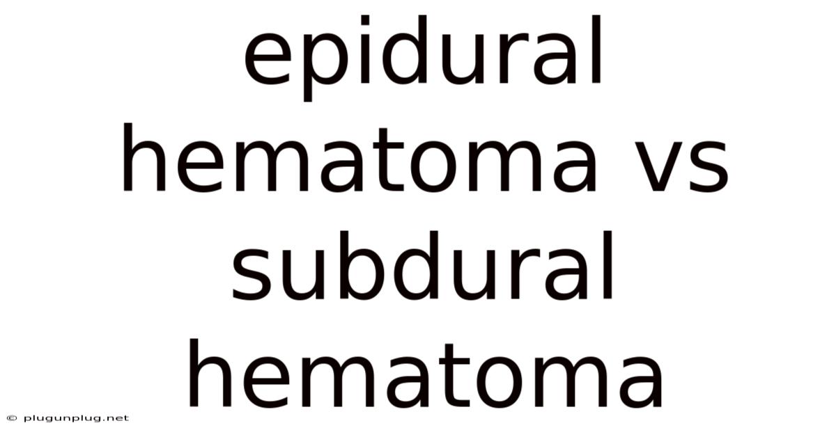 Epidural Hematoma Vs Subdural Hematoma
